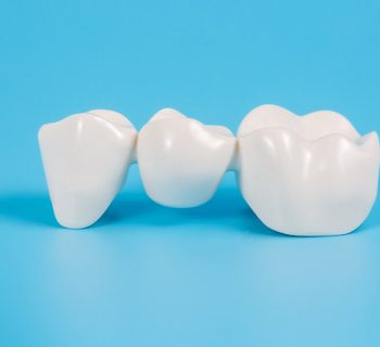 How Long Does It Take for a Dental Bridge to Stop Hurting?