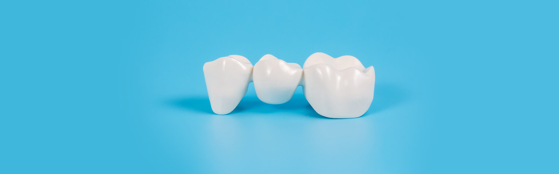 How Long Does It Take for a Dental Bridge to Stop Hurting?
