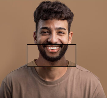 Can You Get Your Teeth Whitened While Having Fillings? Everything You Need to Know