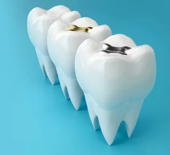 How Dental Fillings Help Stop Tooth Decay Before It Gets Worse