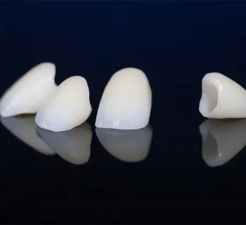When Is a Dental Crown Recommended? What Patients Should Know